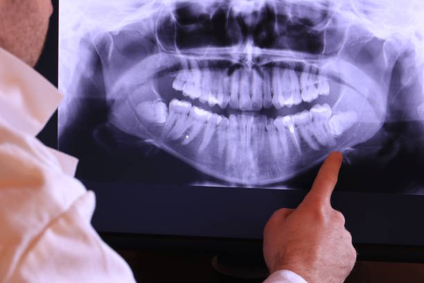 Best Broken or Chipped Tooth Repair in Eagle Point, AL