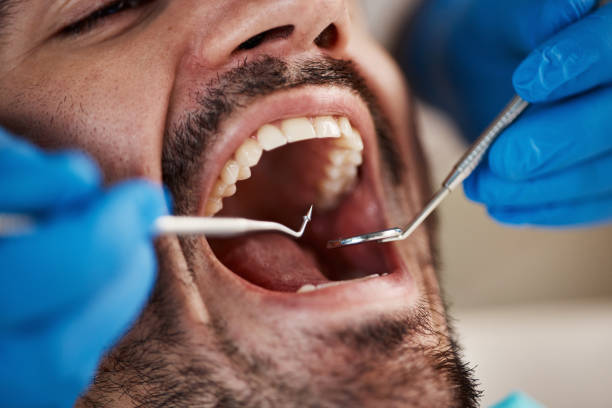 Best Emergency Dental Care for Sports Injuries in Eagle Point, AL